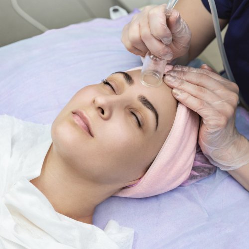 Cosmetic Facial Cupping